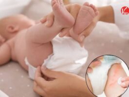 Baby Diaper Myths