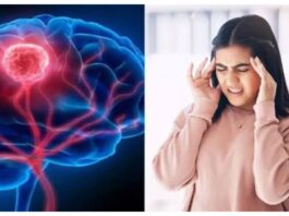 Brain Tumor Symptoms