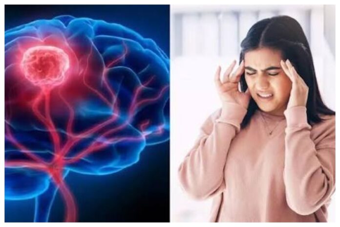 Brain Tumor Symptoms Brain Tumor Symptoms