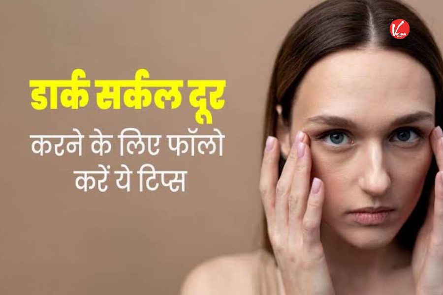 Dark Circle Remedies