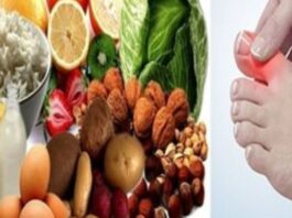 Uric Acid Home Remedy