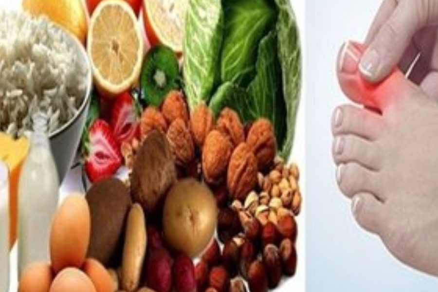 Uric Acid Home Remedy Uric Acid Home Remedy