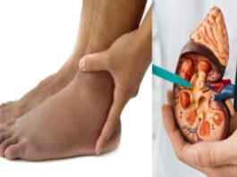 Kidney problem signs