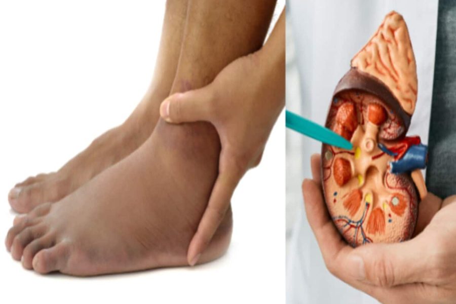 Kidney problem signs