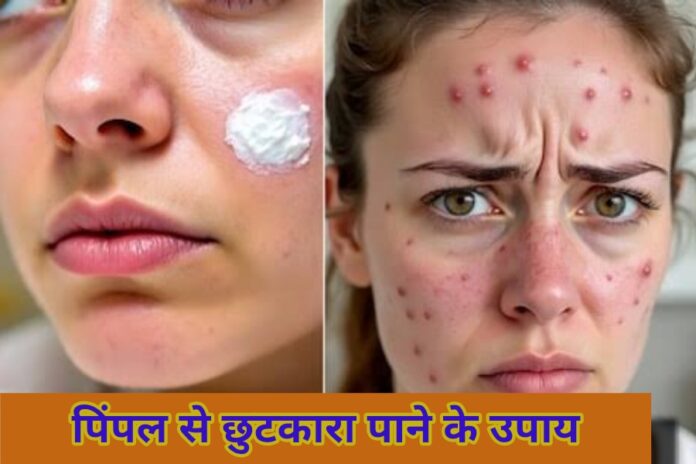 Skin Care Tips