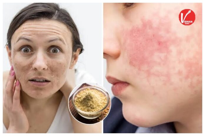 Skin Care Tips